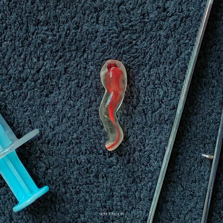 S-Shaped Canal Premolar — 4K-CRV-SS