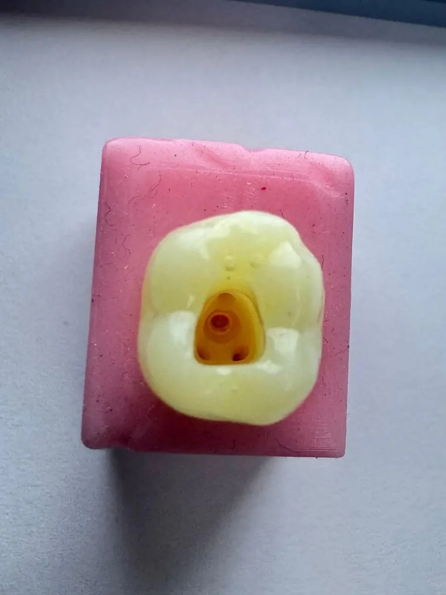 Furcation Perforation Model — image 1 of 2
