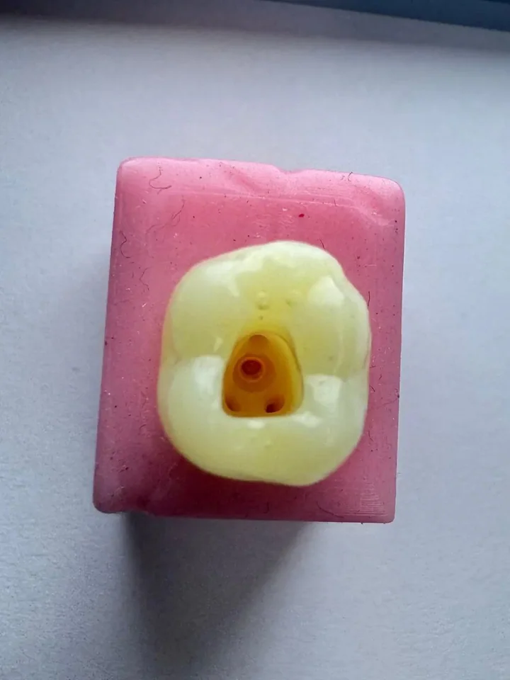 Furcation Perforation Model — 4K-MSH-FP