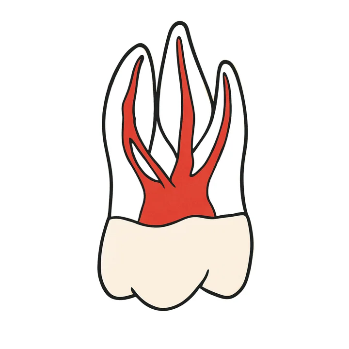 Upper First Molar — with MB2 — 4K-BSC-U6MB2